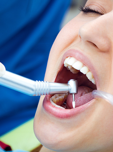 Dentist Melbourne Cbd Get A Healthy Smile 15 Yrs Exp
